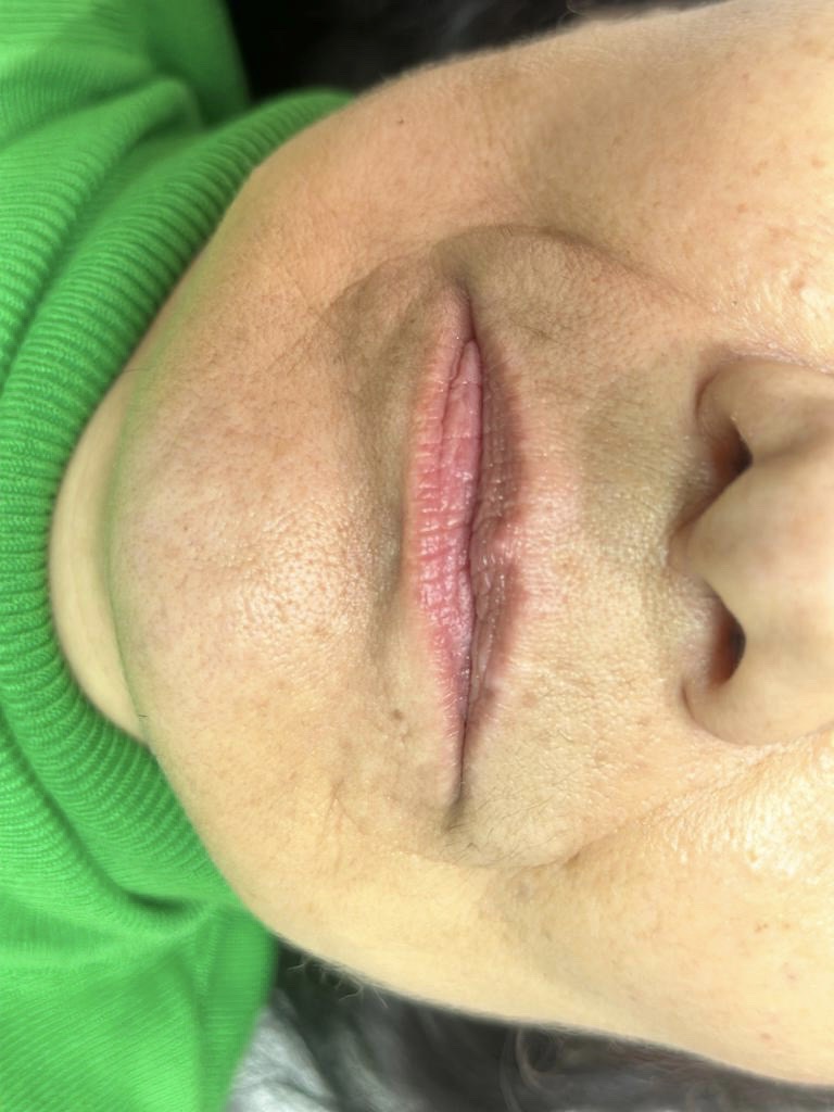IMG 2638